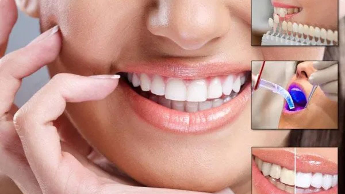 Dental Makeover